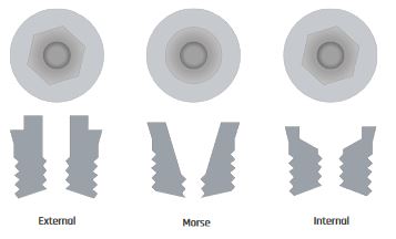 The Implant Internal HEX External Morse Internal